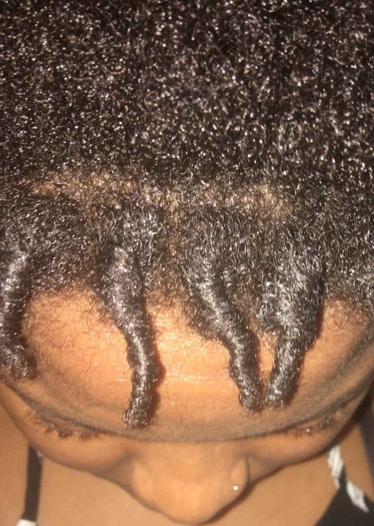 Comb Coils Starter Locs. How to start Locs with Comb Coils